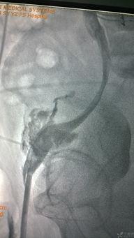 破处出血视频,生理现象与心理关怀